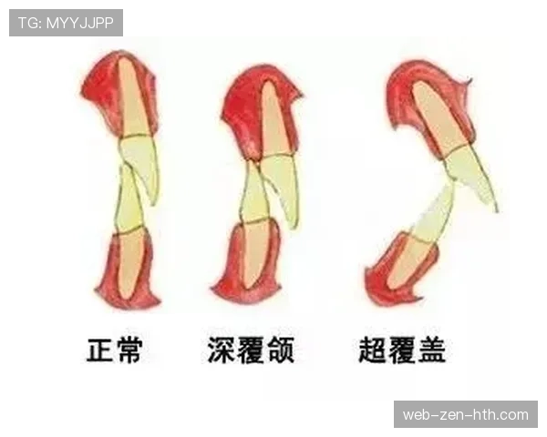 垂直起跳规则解析：什么是合法防守中的垂直起跳？